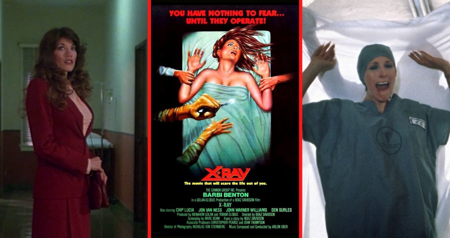XRay (1981) Film Review A LongNeglected Slasher